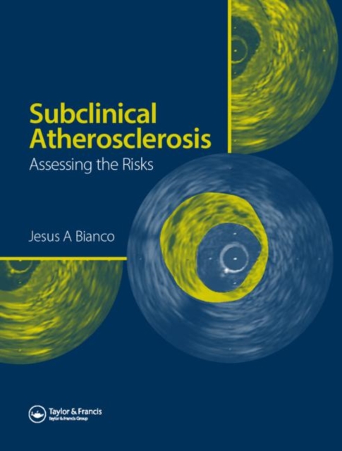 Subclinical Atherosclerosis : Assessing the Risks, Hardback Book