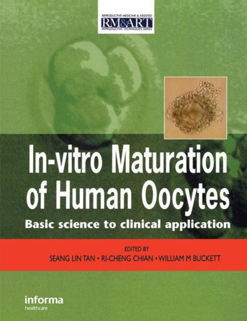 In Vitro Maturation of Human Oocytes, Hardback Book