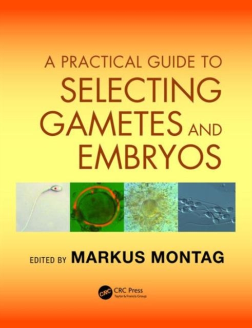 A Practical Guide to Selecting Gametes and Embryos, Hardback Book