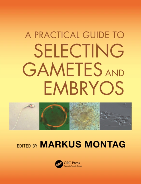 A Practical Guide to Selecting Gametes and Embryos, PDF eBook