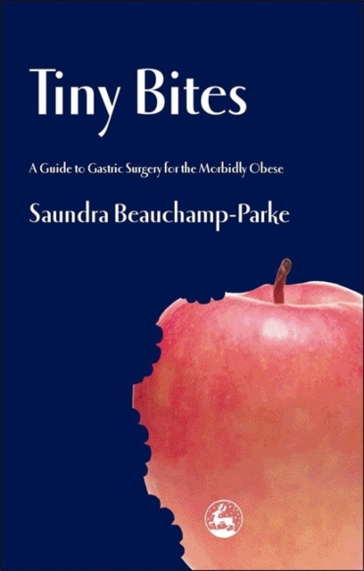 Tiny Bites : A Guide to Gastric Surgery for the Morbidly Obese, Paperback / softback Book