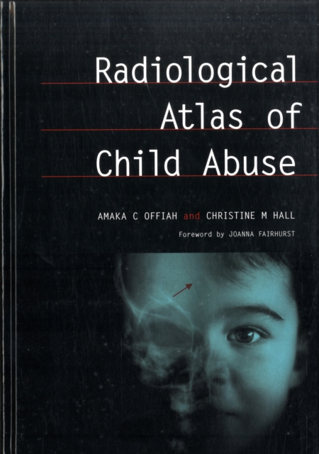 Radiological Atlas of Child Abuse : A Complete Resource for MCQs, v. 1, Hardback Book