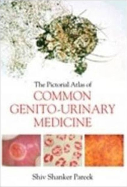 The Pictorial Atlas of Common Genito-Urinary Medicine, Paperback / softback Book
