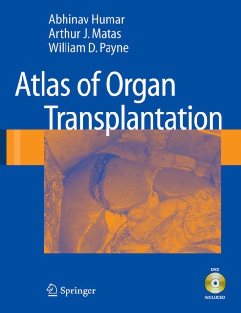 Atlas of Organ Transplantation, PDF eBook