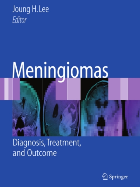 Meningiomas : Diagnosis, Treatment, and Outcome, PDF eBook