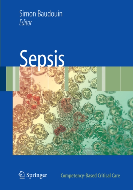 Sepsis, PDF eBook