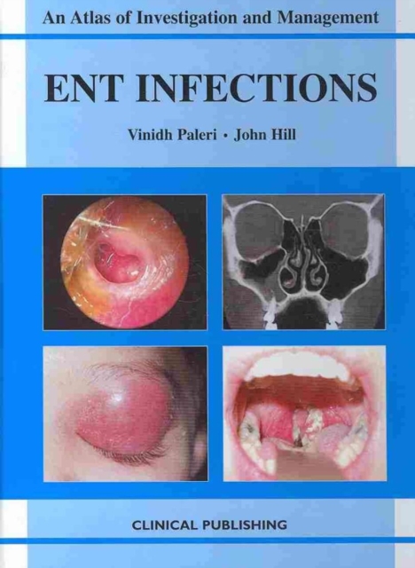 ENT Infections, Hardback Book