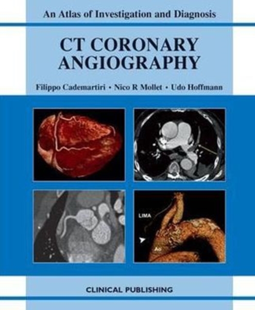 CT Coronary Angiography: Atlas of Investigation and Management, Hardback Book