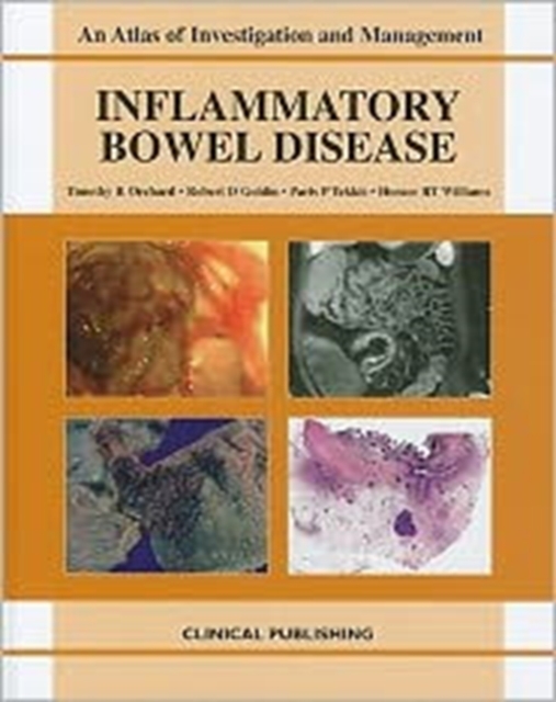 Inflammatory Bowel Disease, Hardback Book