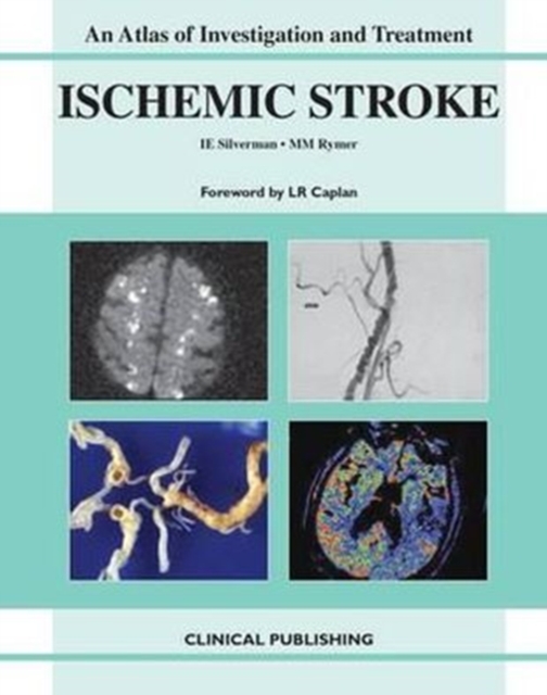 Ischemic Stroke : An Atlas of Investigation and Diagnosis, Hardback Book