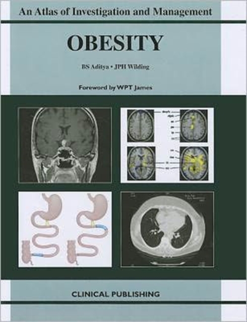 Obesity, Hardback Book
