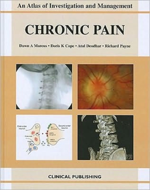 Chronic Pain, Hardback Book