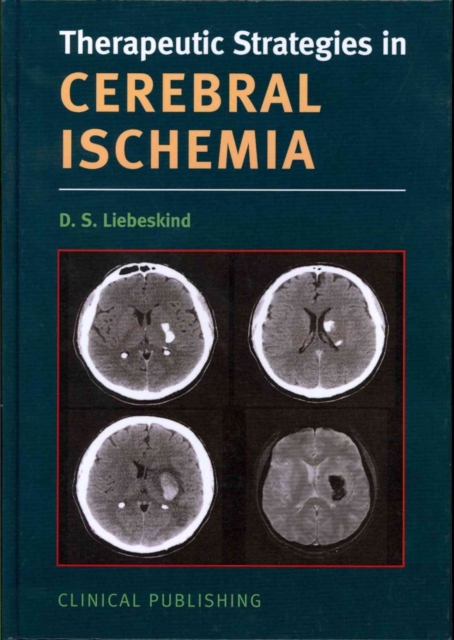Cerebral Ischemia, Hardback Book