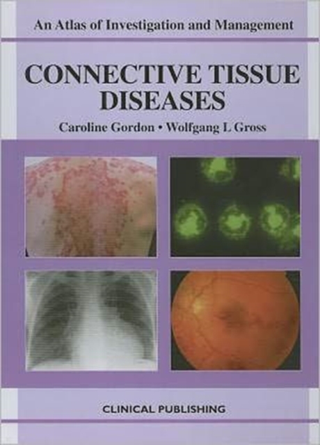 Connective Tissue Diseases, Hardback Book