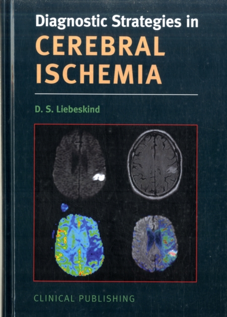 Cerebral Ischemia, Hardback Book