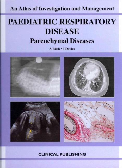 Paediatric Respiratory Disease - Parenchymal Diseases, Hardback Book