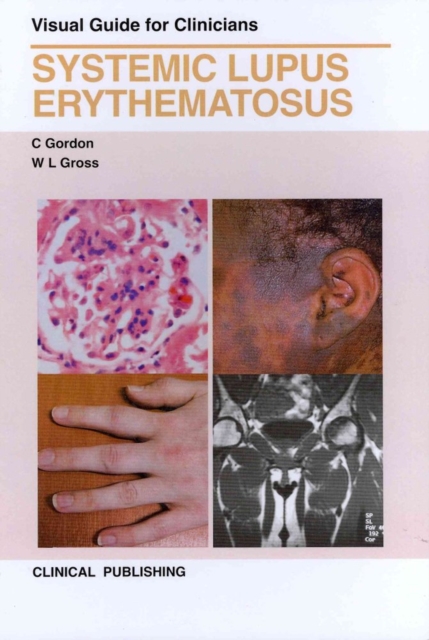 Systemic Lupus Erythematosus : Visual Guide for Clinicians, Hardback Book