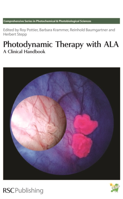 Photodynamic Therapy with ALA : A Clinical Handbook, PDF eBook