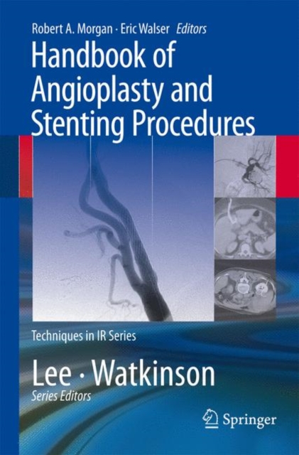 Handbook of Angioplasty and Stenting Procedures, Paperback / softback Book