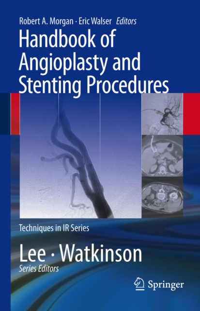 Handbook of Angioplasty and Stenting Procedures, PDF eBook