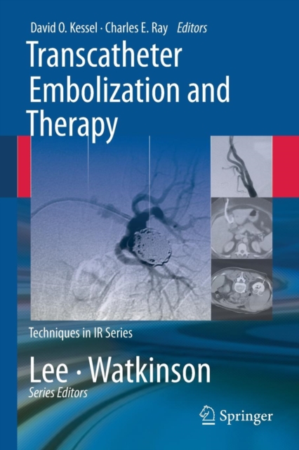 Transcatheter Embolization and Therapy, Paperback / softback Book