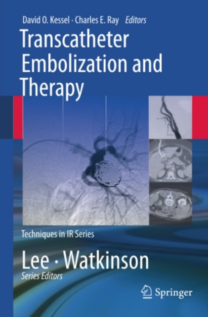 Transcatheter Embolization and Therapy, PDF eBook