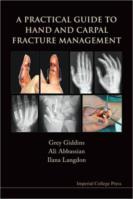 Practical Guide To Hand And Carpal Fracture Management, A, Paperback / softback Book