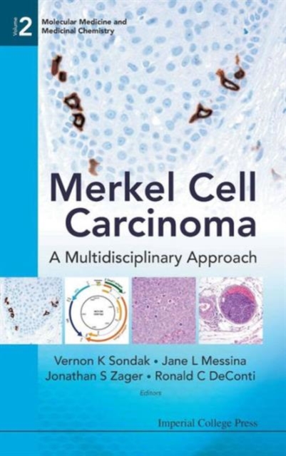 Merkel Cell Carcinoma: A Multidisciplinary Approach, Hardback Book
