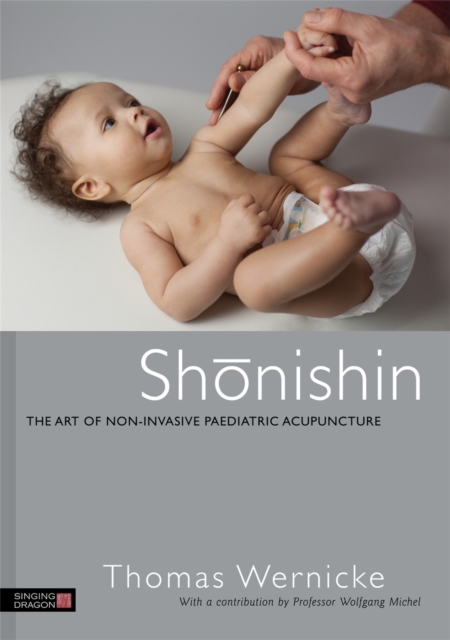 Shonishin : The Art of Non-Invasive Paediatric Acupuncture, Paperback / softback Book