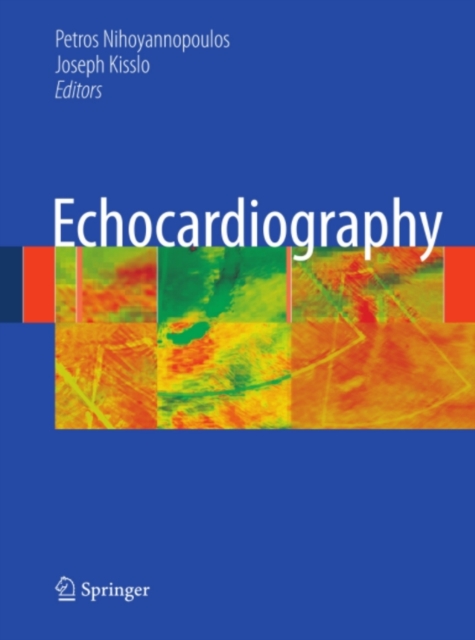 Echocardiography, PDF eBook