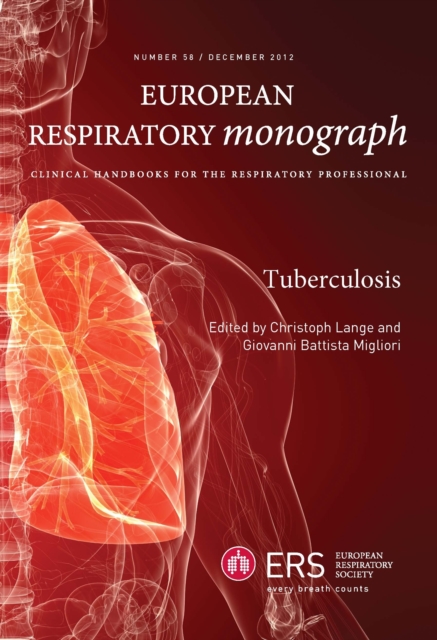 Tuberculosis, PDF eBook