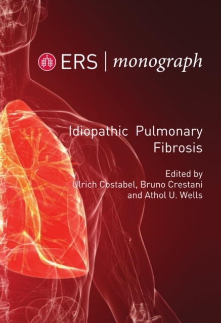 Idiopathic Pulmonary Fibrosis, PDF eBook