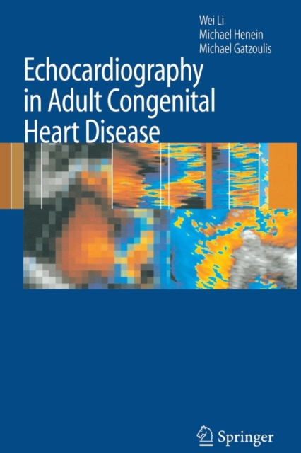 Echocardiography in Adult Congenital Heart Disease, Paperback / softback Book