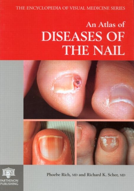 An Atlas of Diseases of the Nail, Hardback Book