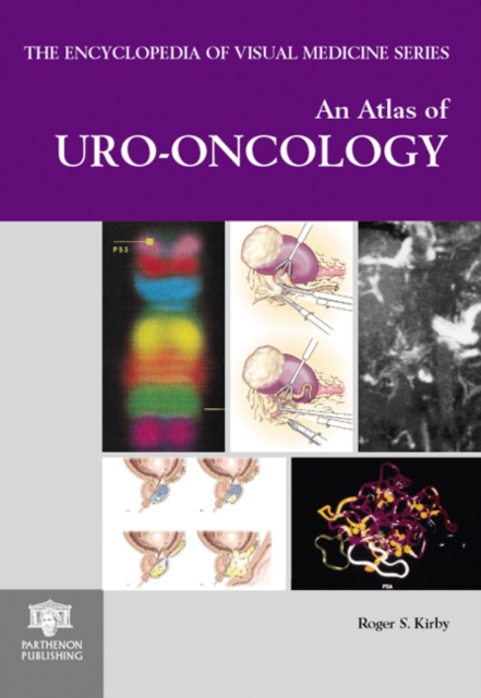 An Atlas of Uro-oncology, Hardback Book