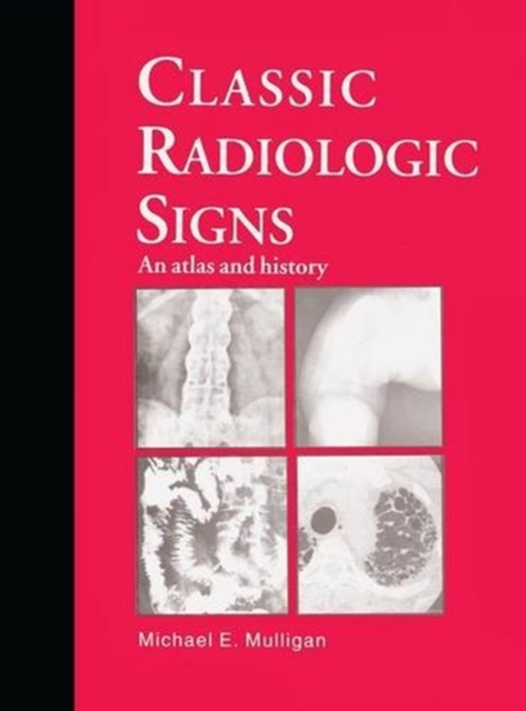 Classic Radiologic Signs : An Atlas and History, Hardback Book