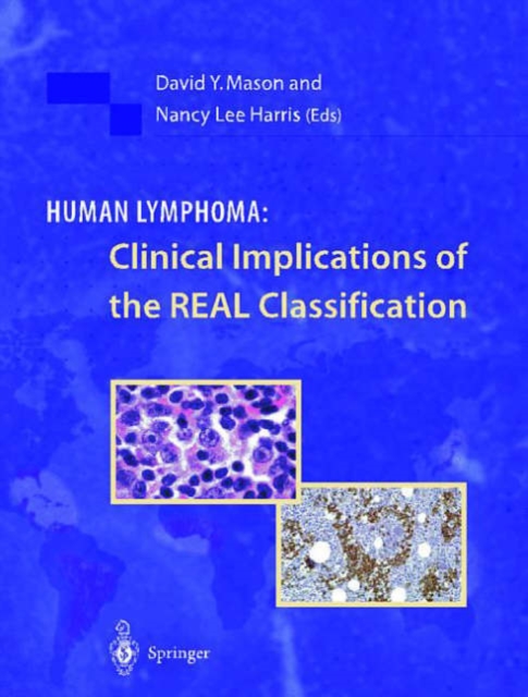 Human Lymphoma: Clinical Implications of the Real Classification, Hardback Book