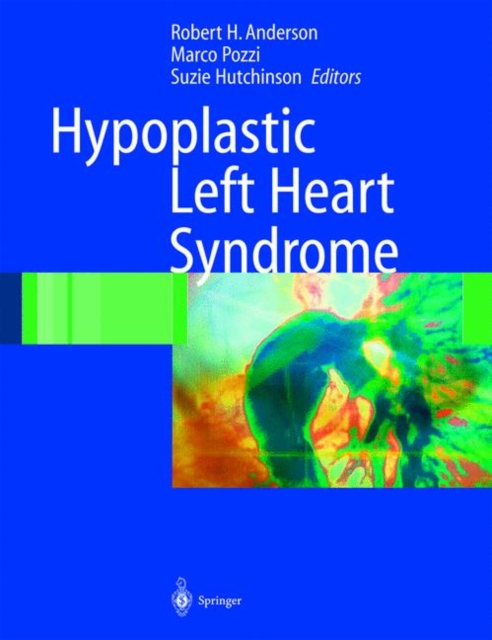 Hypoplastic Left Heart Syndrome, Hardback Book