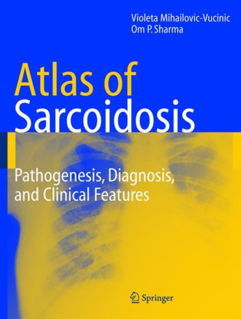 Atlas of Sarcoidosis : Pathogenesis, Diagnosis and Clinical Features, Hardback Book