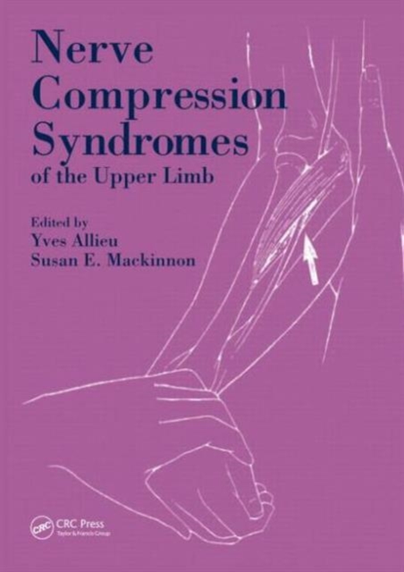 Nerve Compression Syndromes of the Upper Limb, Hardback Book