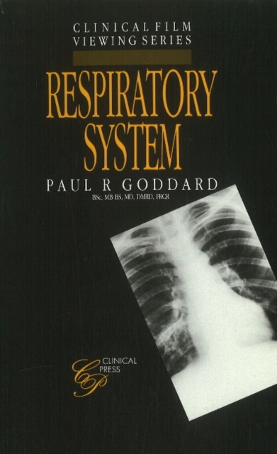 Respiratory System, Paperback / softback Book