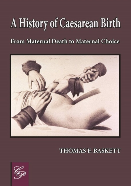 History of Caesarean Birth : From Maternal Death to Maternal Choice, Paperback / softback Book