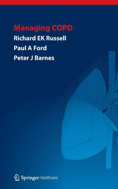 Managing COPD, Paperback / softback Book