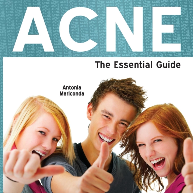 Acne : The Essential Guide, Paperback Book