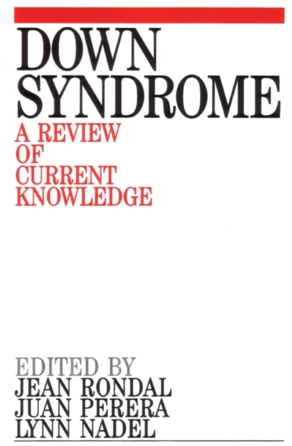 Down Syndrome : A Review of Current Knowledge, Paperback / softback Book