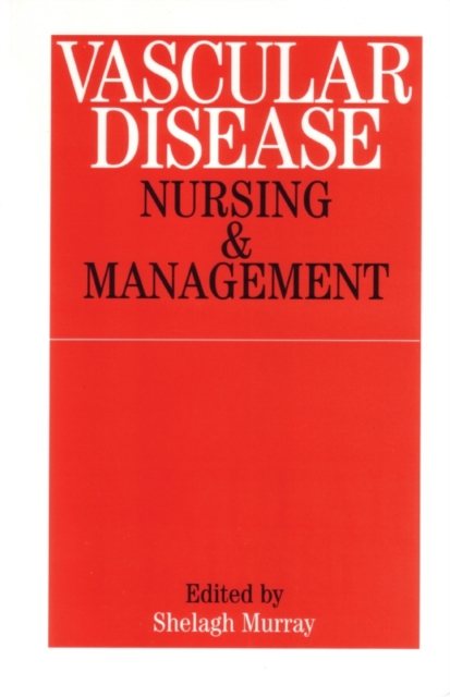 Vascular Disease : Nursing and Management, Paperback / softback Book