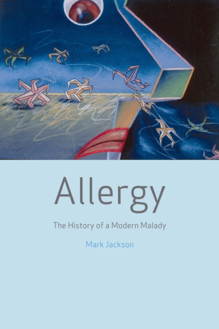 Allergy : The History of a Modern Malady, Hardback Book