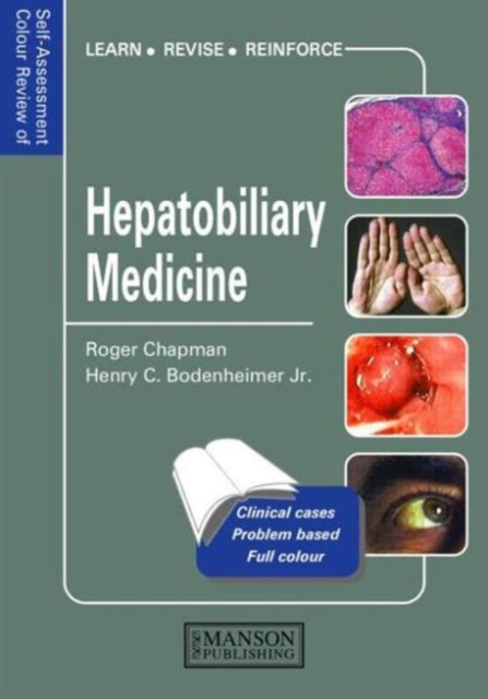 Hepatobiliary Medicine, Paperback / softback Book