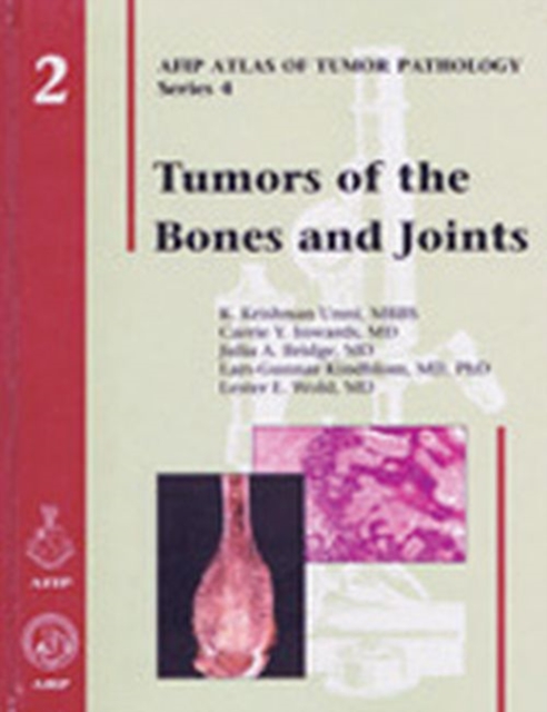 Tumors of the Bones and Joints, Hardback Book