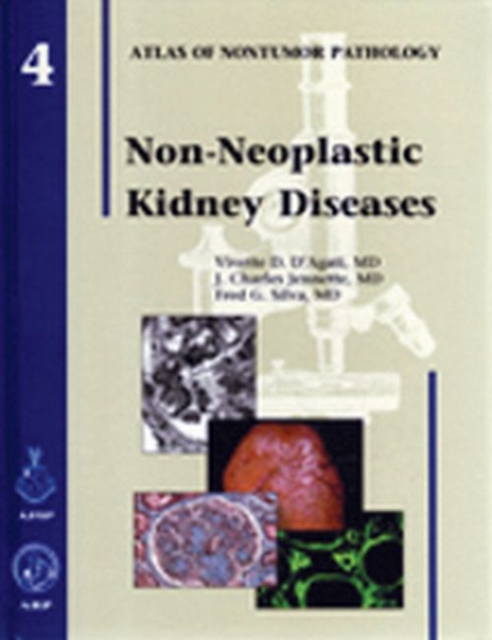 Non-Neoplastic Kidney Diseases, Hardback Book